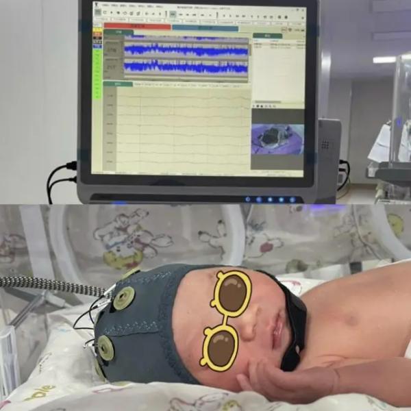 新生兒